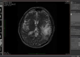 MedINRIA x64 screenshot